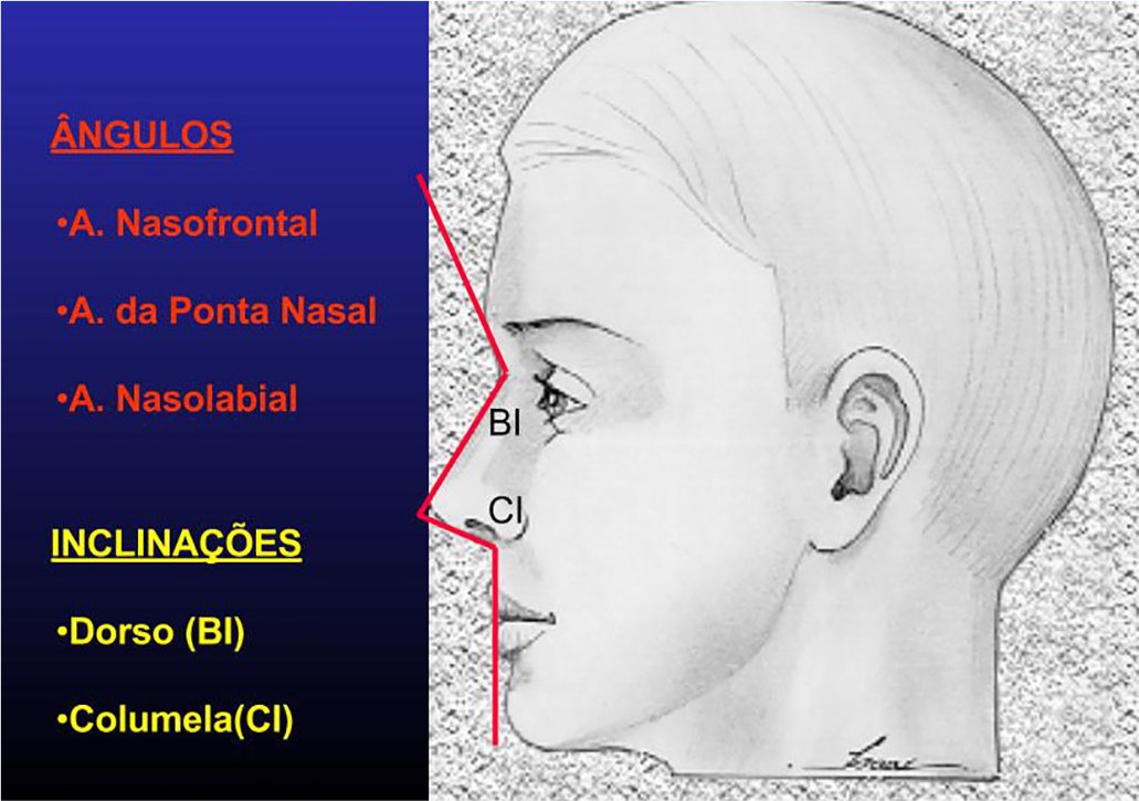Ângulos e inclinações na análise facial para rinoplastia