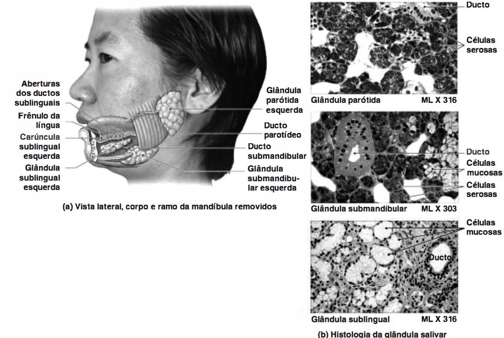 Glândulas parótida, submandibular e sublingual com histologia