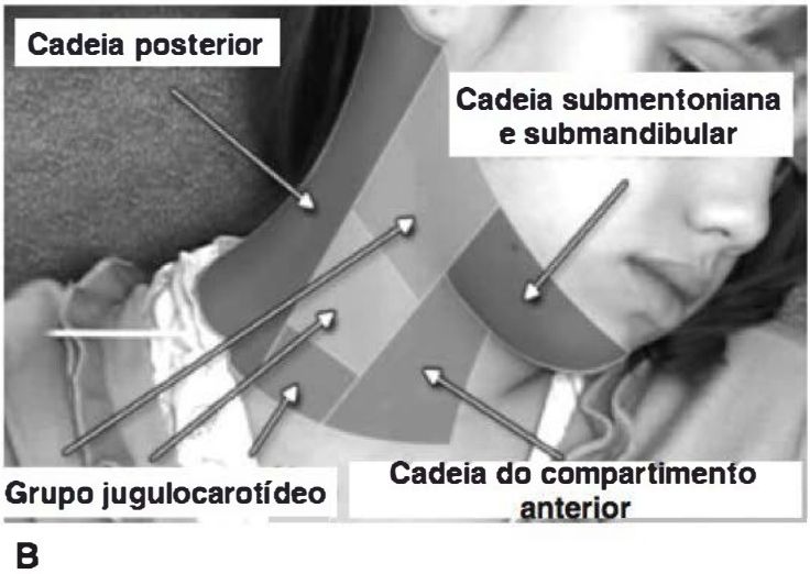Grupos de linfonodos cervicais sobre foto de perfil