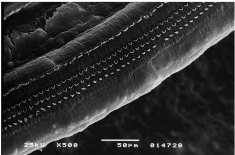 Microscopia eletrônica de cóclea normal de cobaia