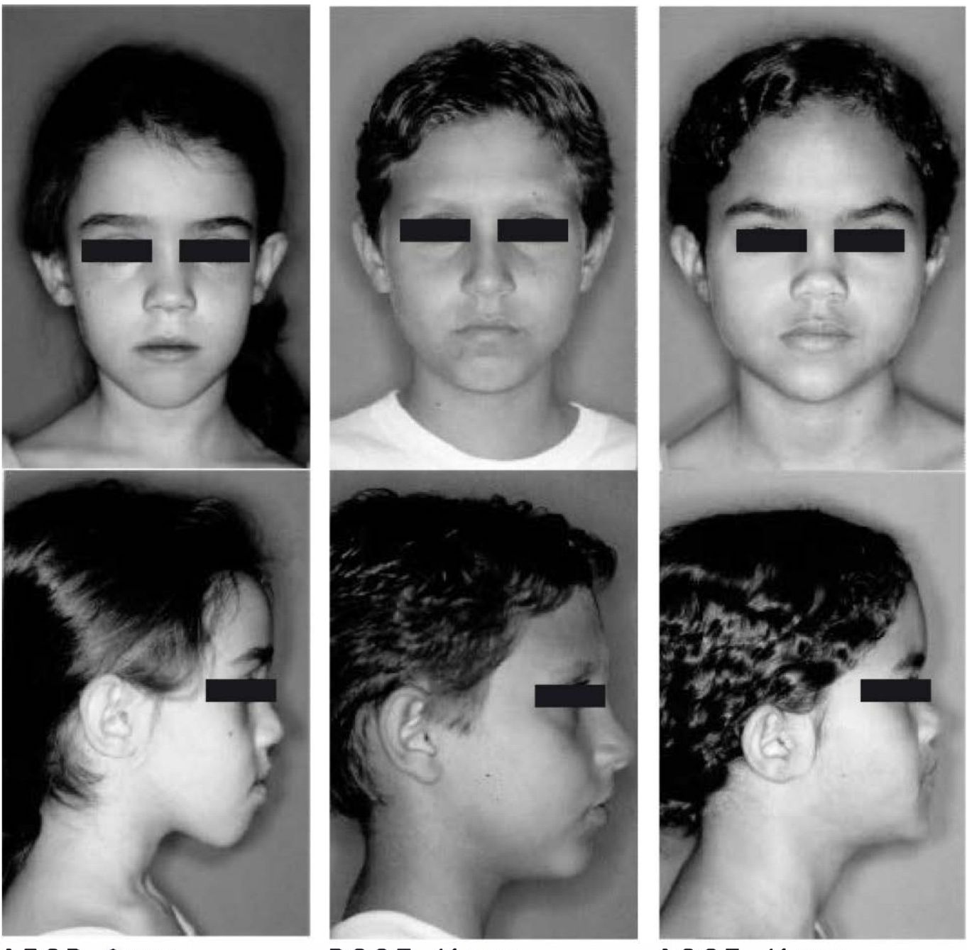 Três crianças em vista frontal e perfil com diferentes tipos faciais