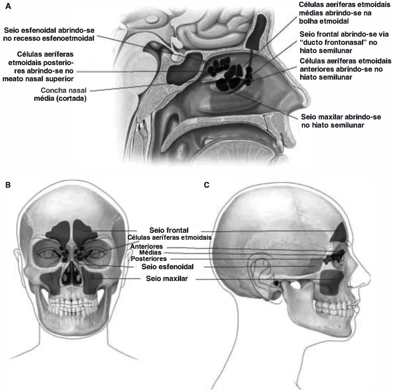 Seios paranasais em vista medial, anterior e lateral, com os locais de drenagem
