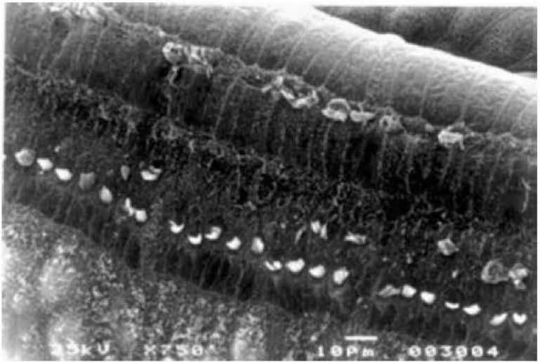 Microscopia eletrônica de cóclea de cobaia com lesão extensa das células ciliadas externas após amicacina