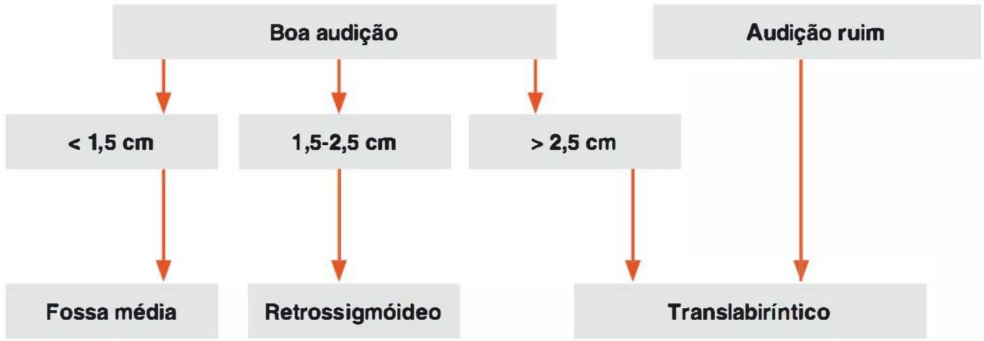 Fluxograma do acesso cirúrgico: boa audição e menor que 1,5 cm fossa média; 1,5 a 2,5 cm retrossigmóideo; maior que 2,5 cm ou audição ruim translabiríntico