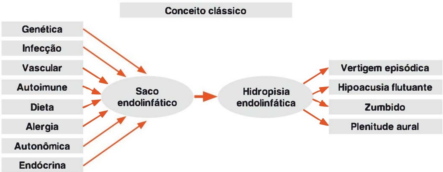 Conceito clássico: etiologias atuam no saco endolinfático, causam hidropisia, que causa vertigem, hipoacusia, zumbido e plenitude