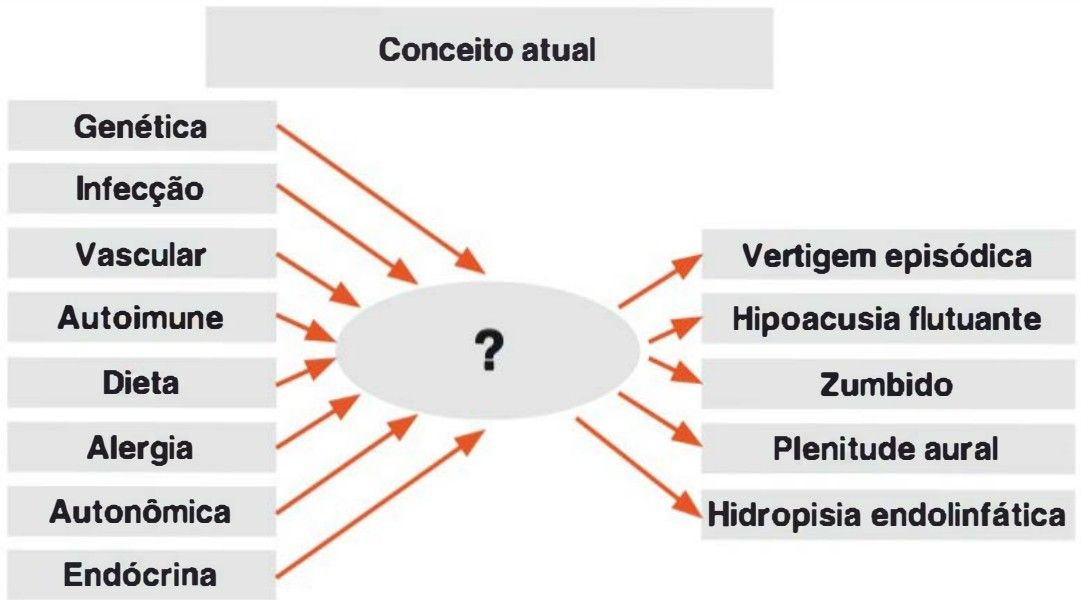 Conceito atual: etiologias levam a mecanismo desconhecido que produz os sintomas e a hidropisia endolinfática como mais uma manifestação